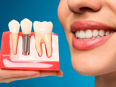 Tratamentos Odontológicos em Gurupi - TO