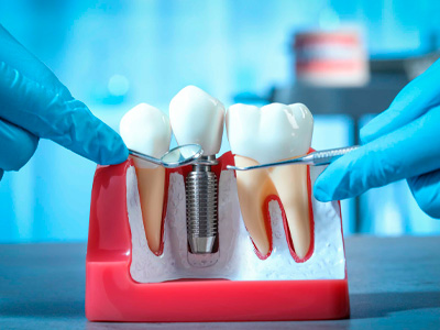 Diferenciais Odontológicos - Gurupi -TO